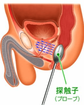 深触子（プローブ）